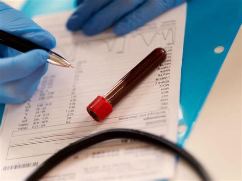 why do blood tests take place